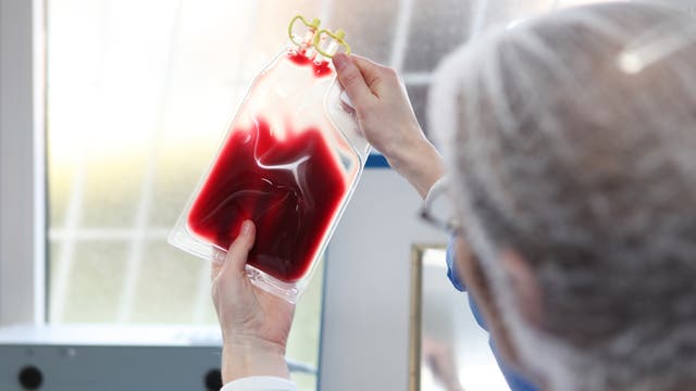 Ein Arzt in Hazmat-Kleidung hält eine Blutkonserve gegens Licht.