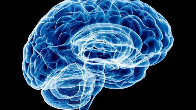 Röntgenbild eines Gehirns