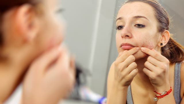 Teenager mit Hautproblemen vor dem Spiegel 
