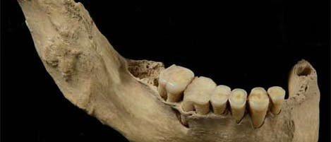 Unterkiefer des 40 000 Jahre alten menschlichen Skeletts aus China Unterkiefer des 40 000 Jahre alten menschlichen Skeletts aus China