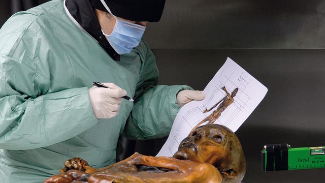 Untersuchung am Ötzi
