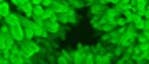 Nano-Seeigel Nano-Seeigel