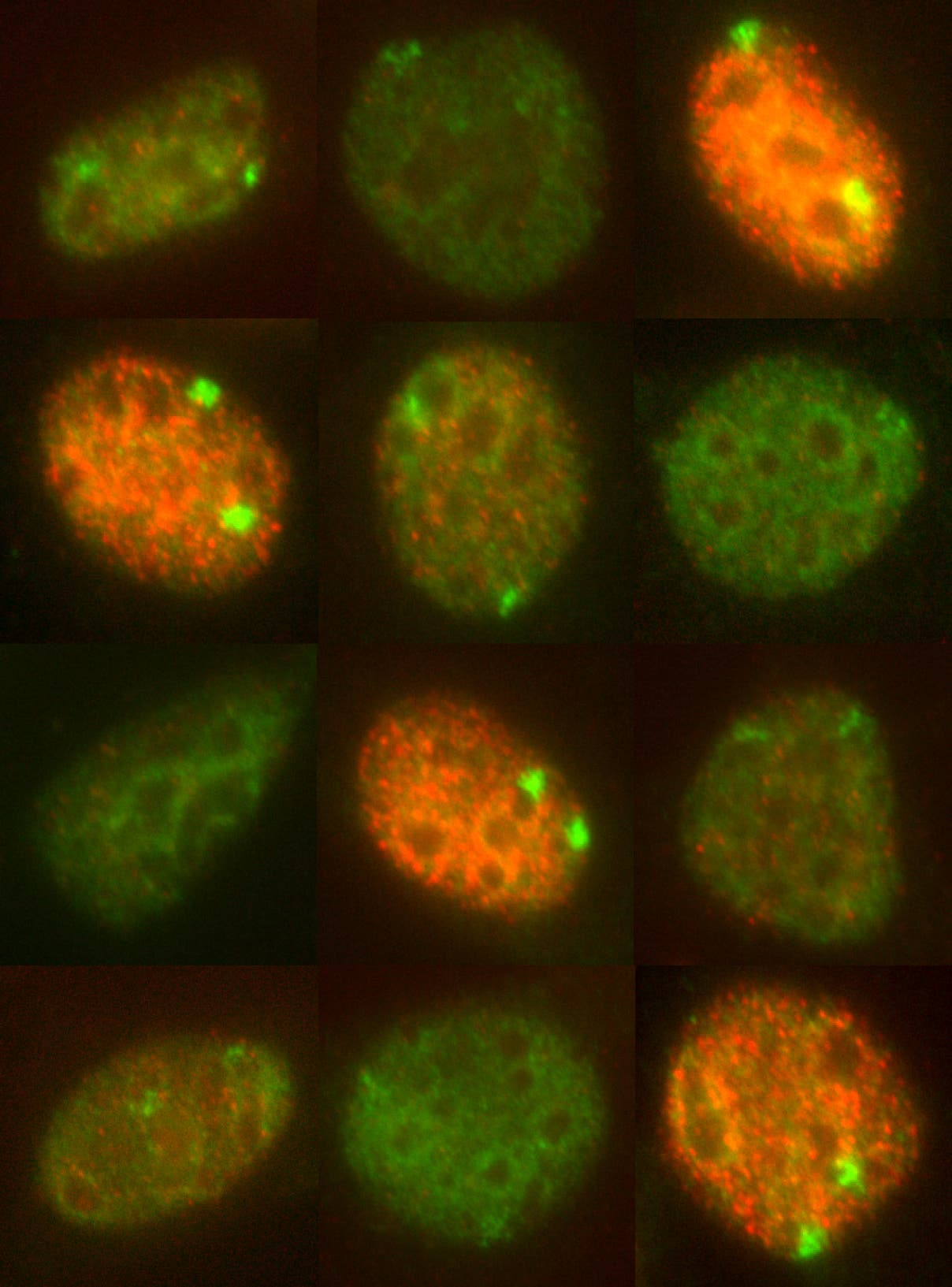 Die lncRNA Xist in weiblichen Zellen