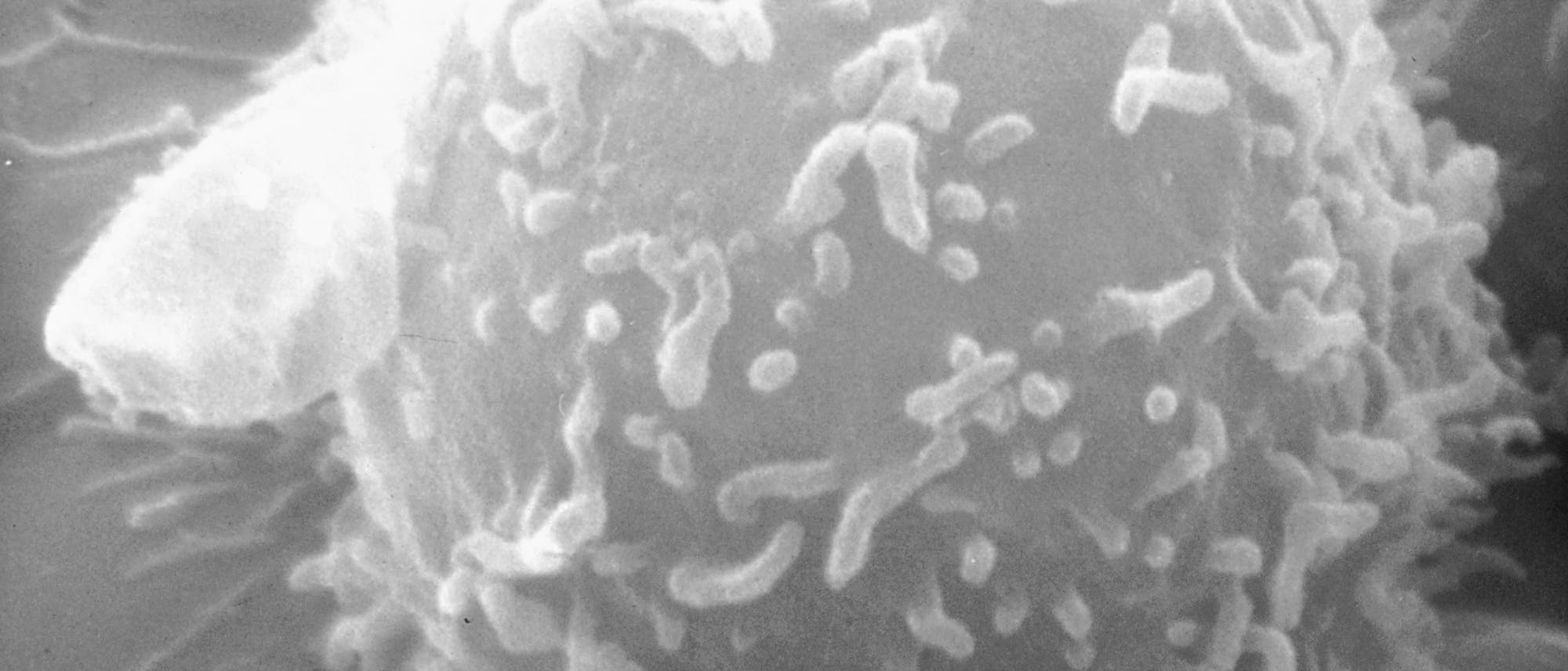 T-Lymphozyt des Menschen T-Lymphozyt des Menschen