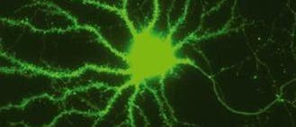 Nervenzelle mit intakten Synapsen