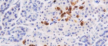 Gewebeschnitt mit Proteinfärbung Gewebeschnitt mit Proteinfärbung