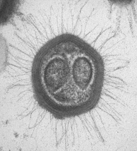 Mimivirus Mimivirus