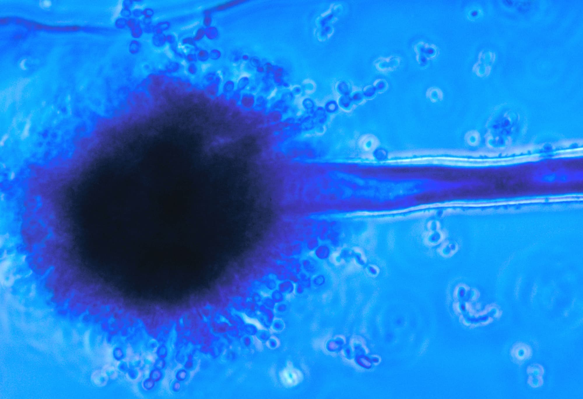 Der Schimmelpilz Aspergillus flavus unter dem Mikroskop Der Schimmelpilz Aspergillus flavus unter dem Mikroskop