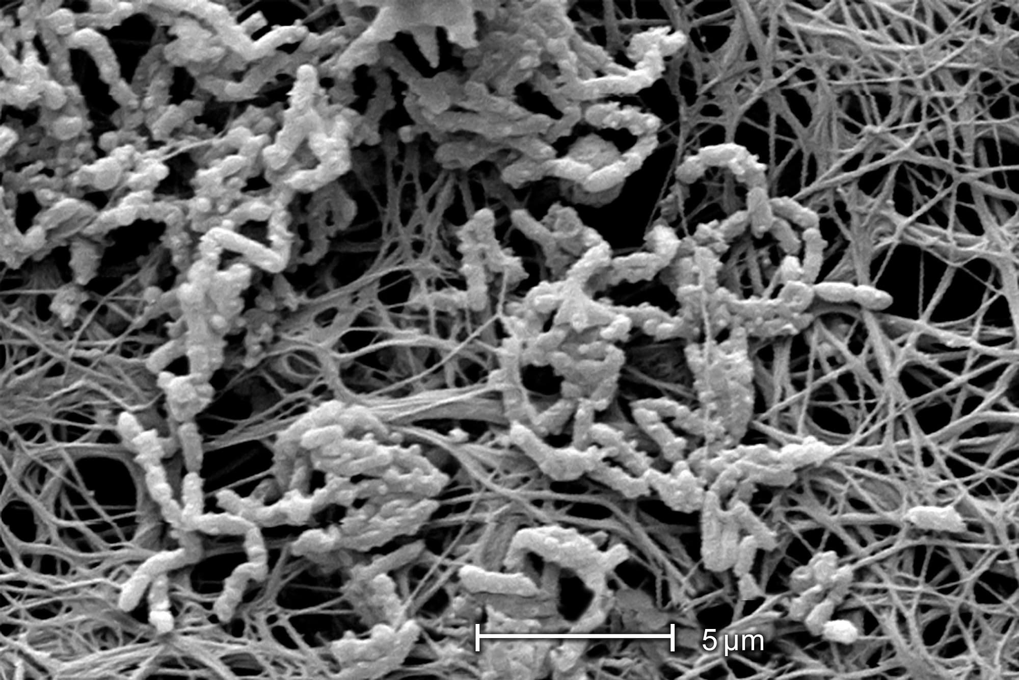 Achromobacter xylosoxidans Achromobacter xylosoxidans