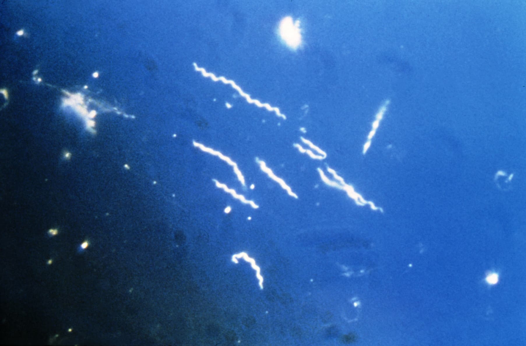 Borrelien unter dem Mikroskop Borrelien unter dem Mikroskop