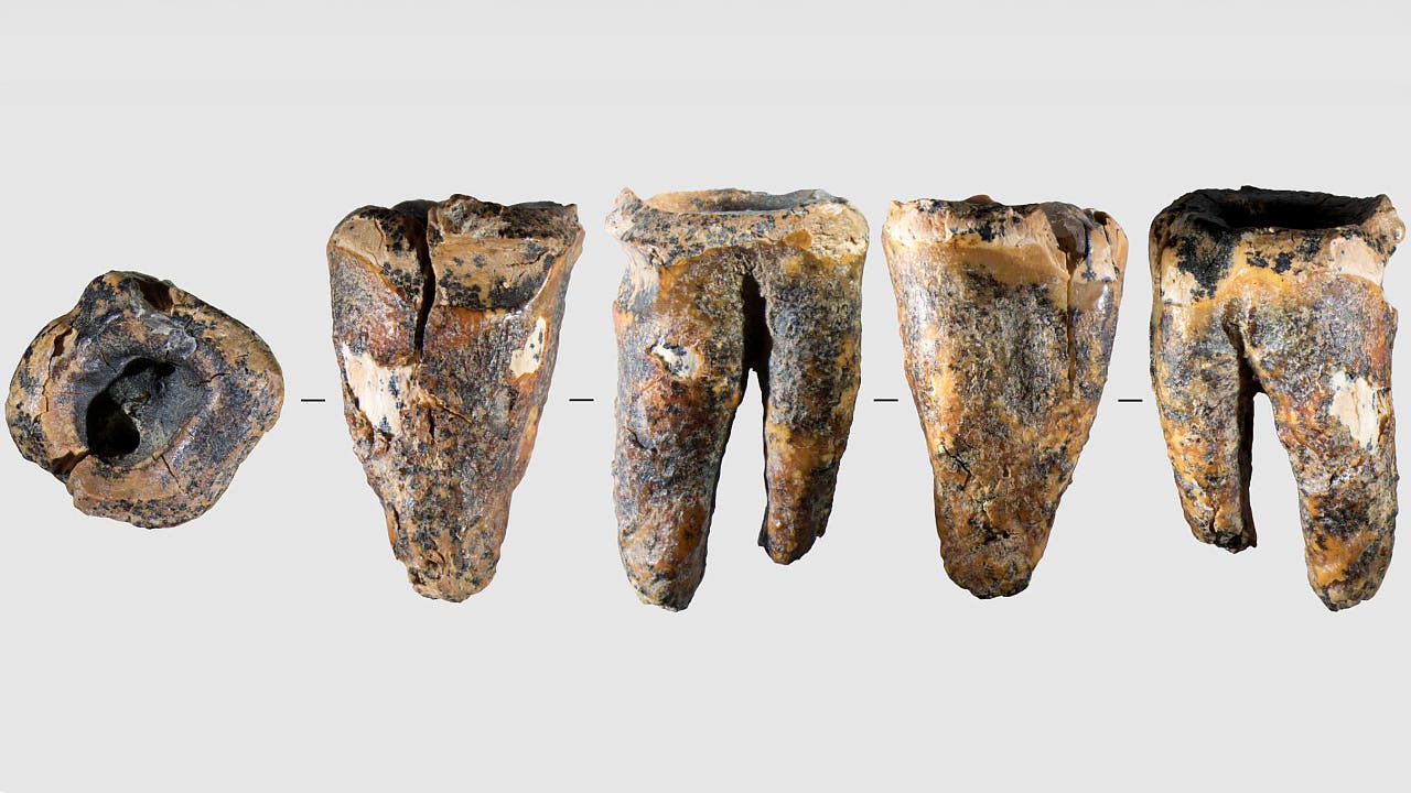 Neandertaler: Frühester Nachweis einer Kariesbehandlung