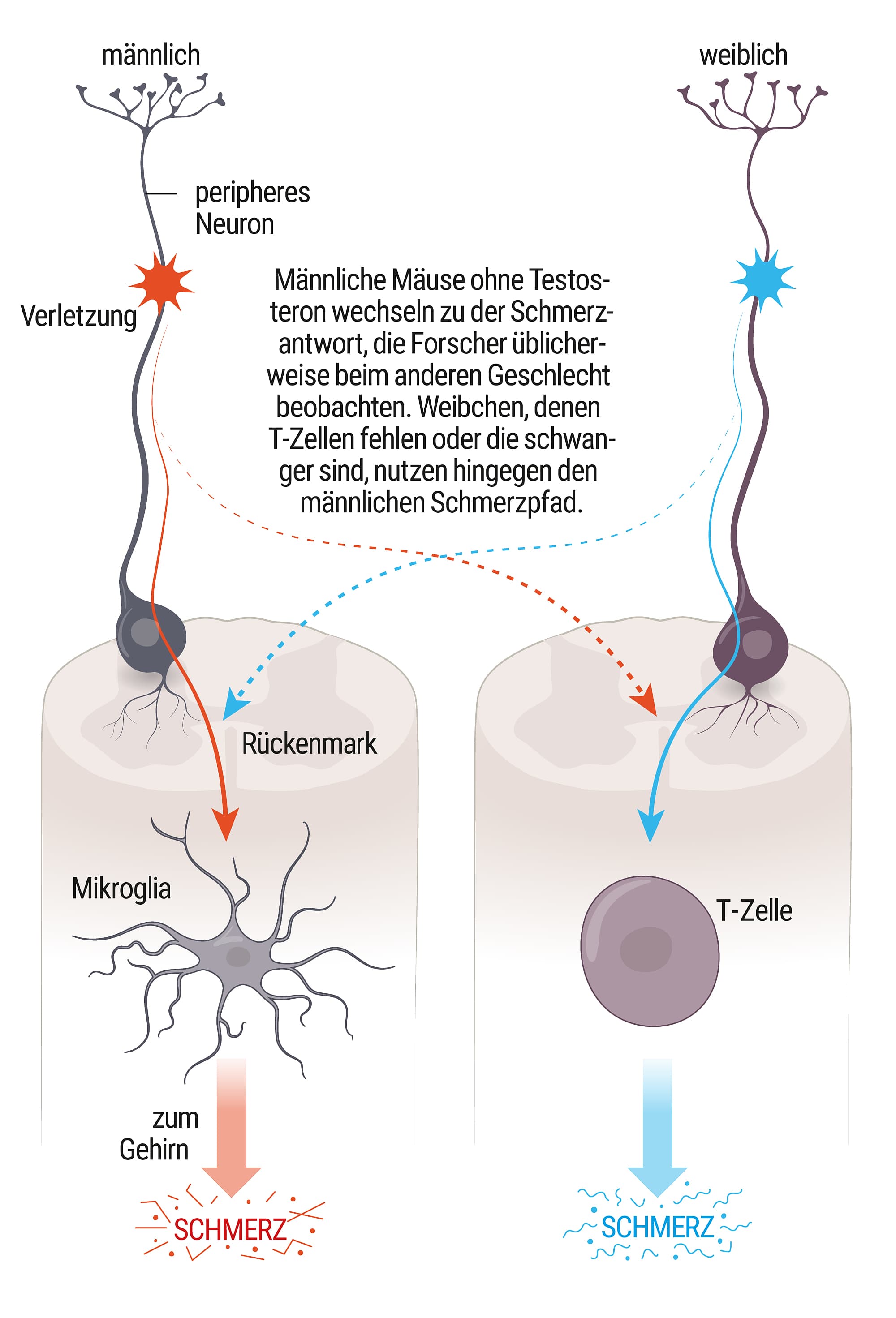 Wie Schmerz entsteht Wie Schmerz entsteht