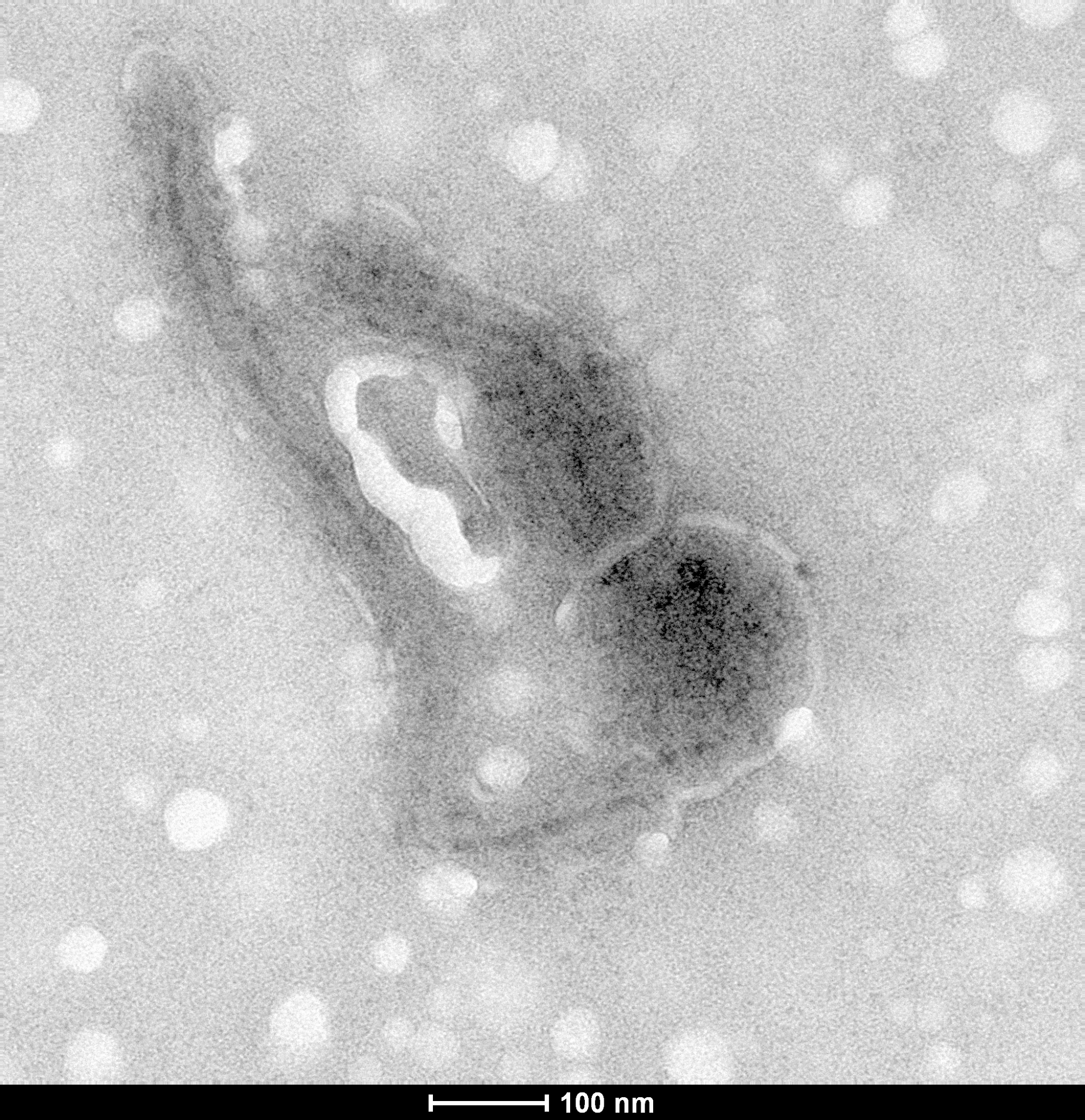 Ebolavirus Ebolavirus