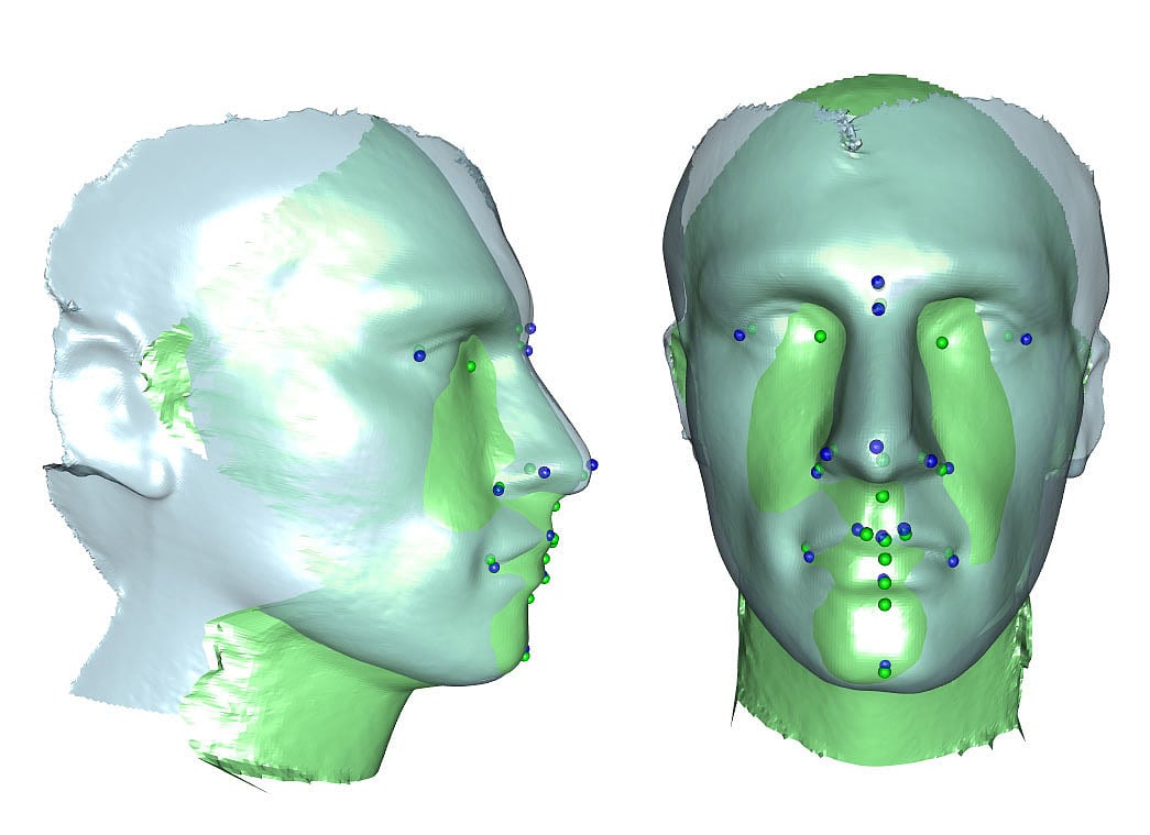 Vergleich mit herkömmlicher 3-D-Aufnahme Vergleich mit herkömmlicher 3-D-Aufnahme