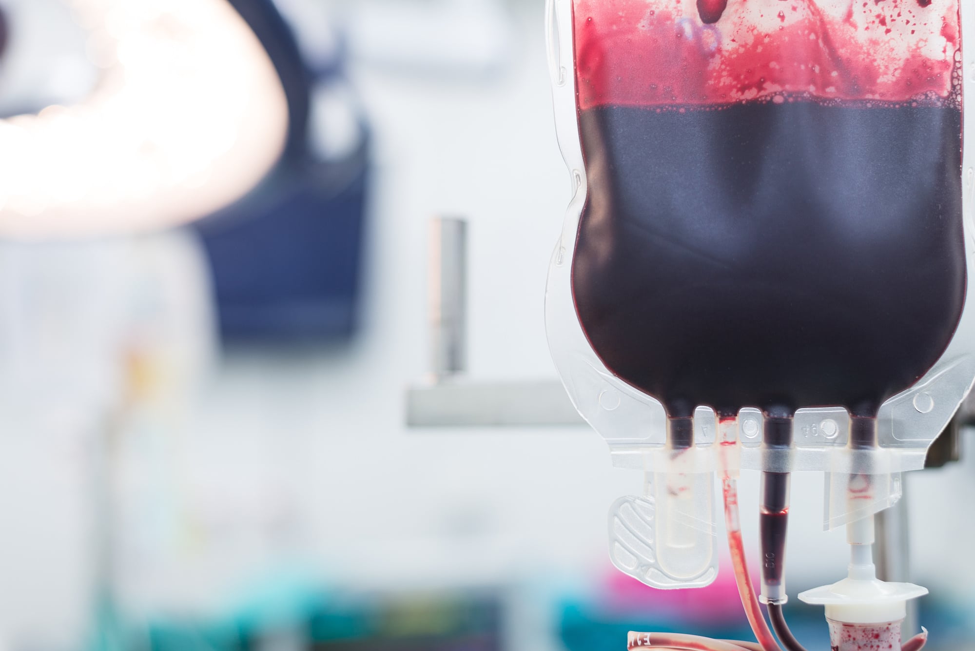 Infusionsbeutel mit Blut hängt vor unscharfem weißem Hintergrund Infusionsbeutel mit Blut hängt vor unscharfem weißem Hintergrund