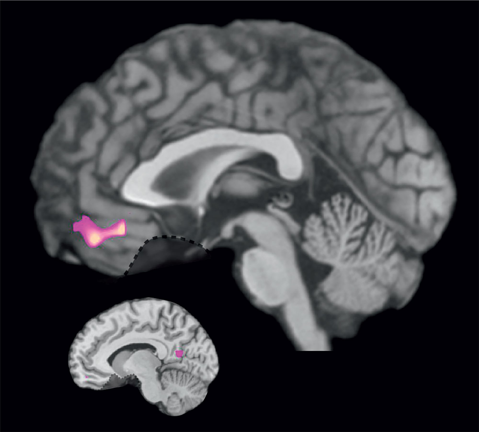 Neuronale Spuren der Dankbarkeit Neuronale Spuren der Dankbarkeit