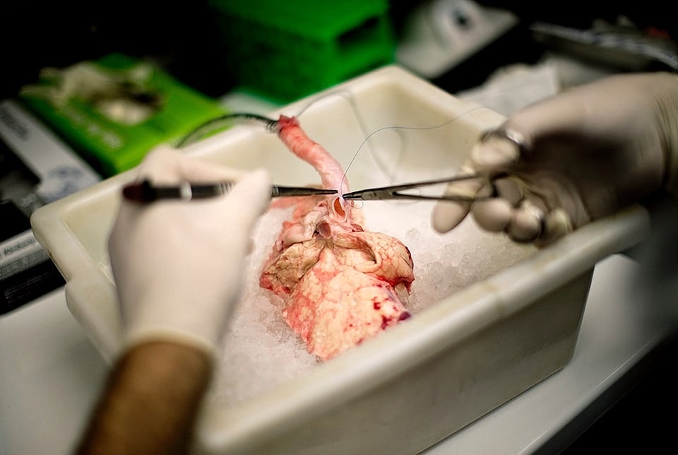 Transplantation von Schweineorganen Transplantation von Schweineorganen