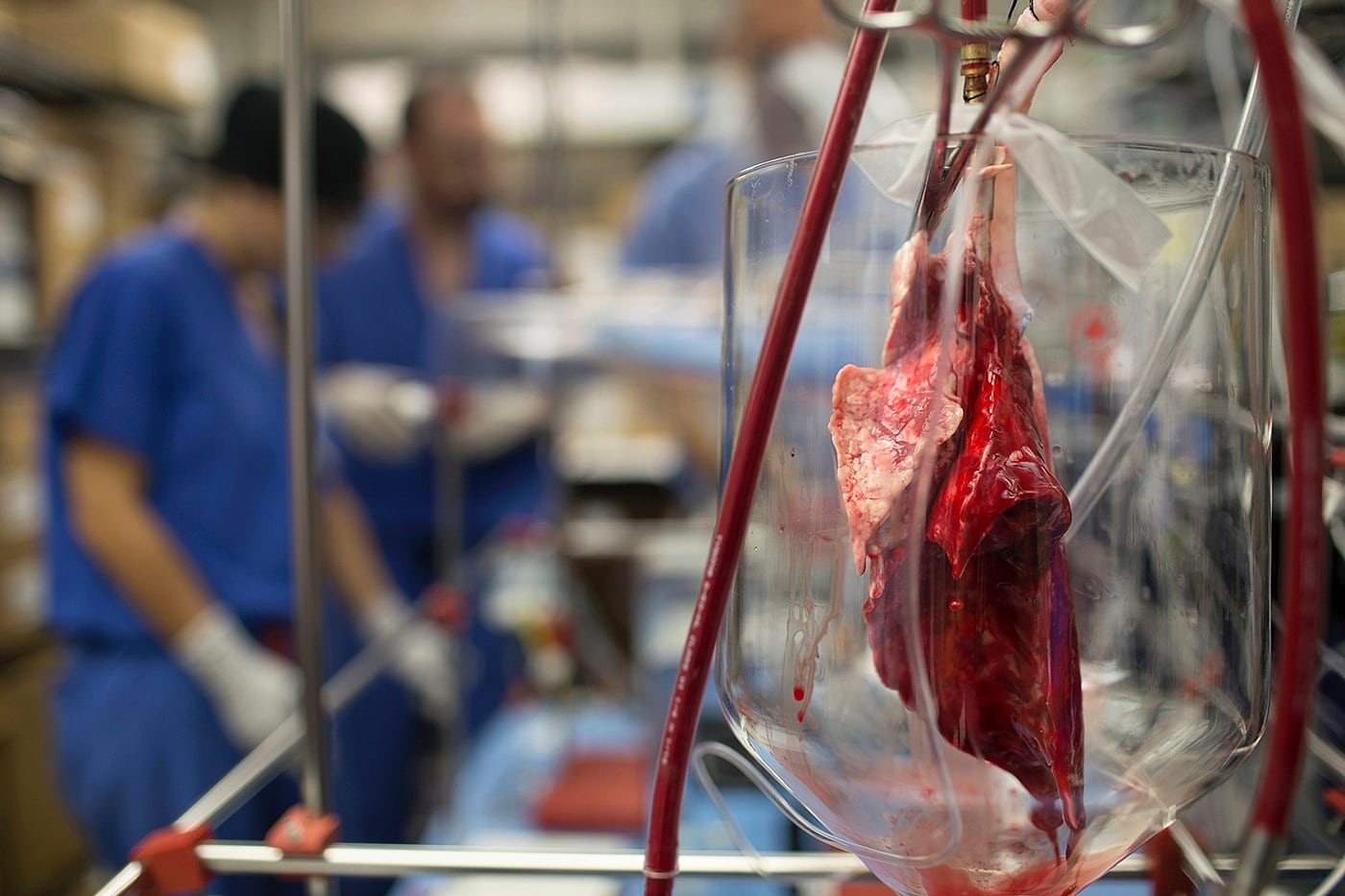 Lunge und Leber vor dem Retransplantieren Lunge und Leber vor dem Retransplantieren