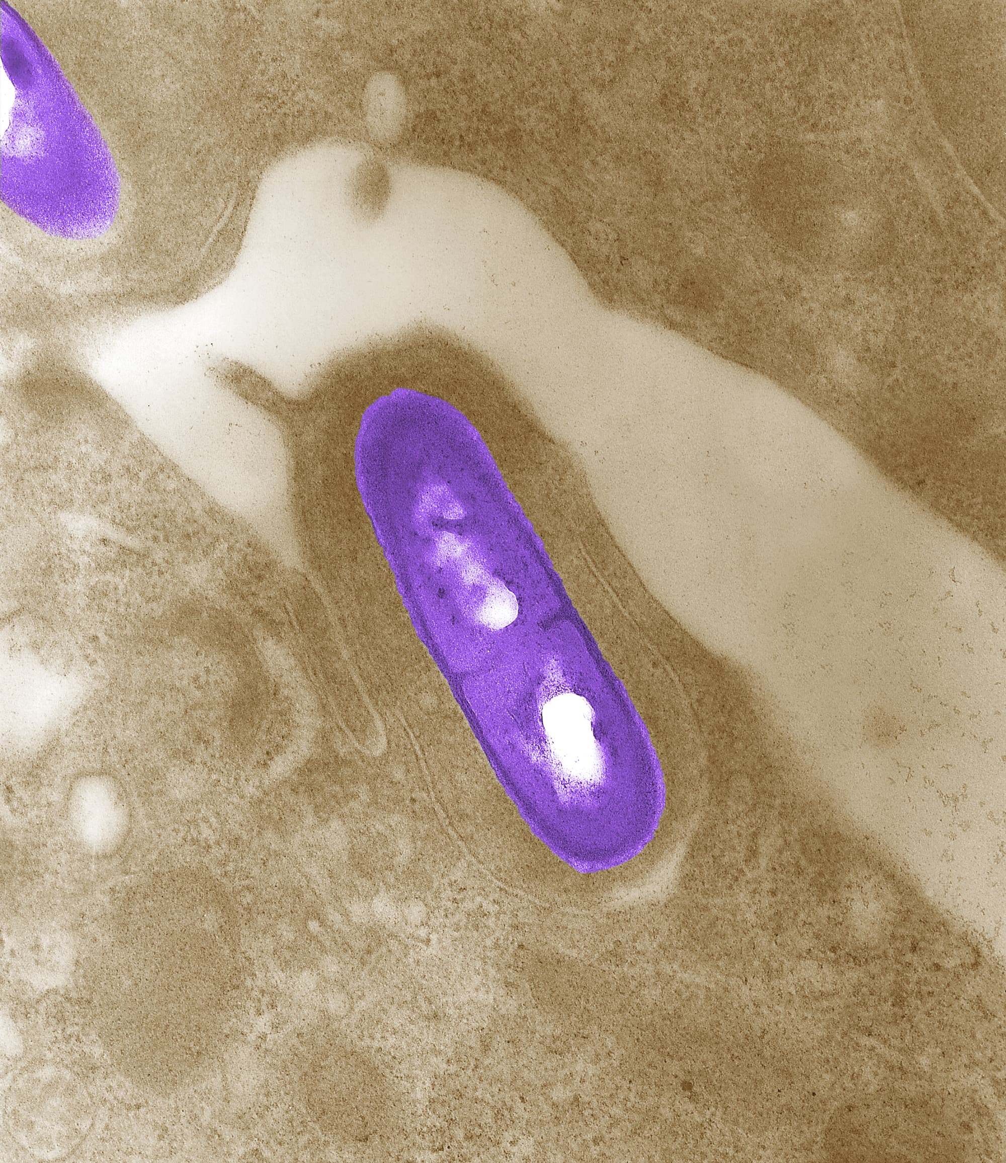 Listeria monozytogenes Listeria monozytogenes