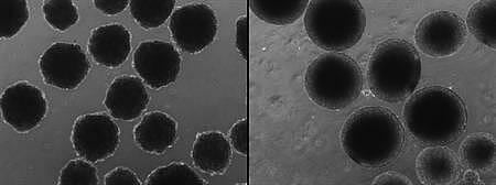 Hirnorganoide Hirnorganoide