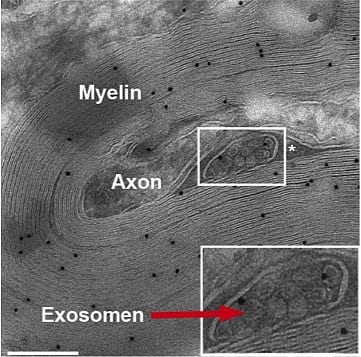 Versorgung des Axons durch Exosom Versorgung des Axons durch Exosom