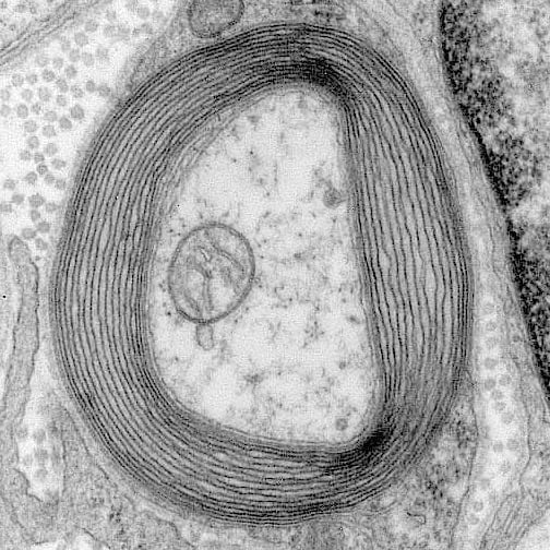 Myelinisiertes Neuron Myelinisiertes Neuron