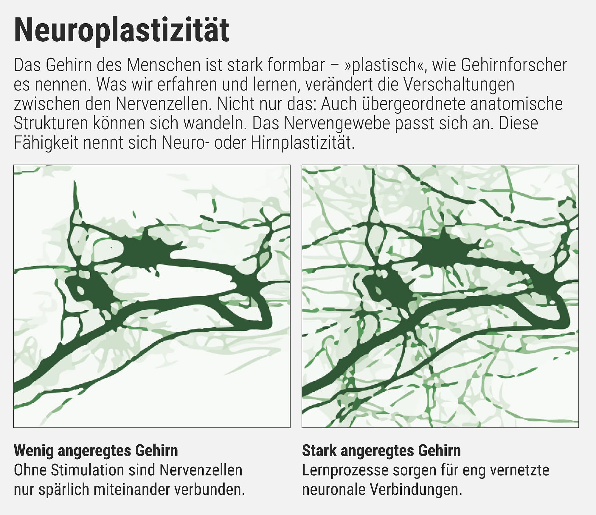Wie die Grafik zeigt, ist das Gehirn stark formbar – etwa durch regelmäßige Bewegung. Wie die Grafik zeigt, ist das Gehirn stark formbar – etwa durch regelmäßige Bewegung.