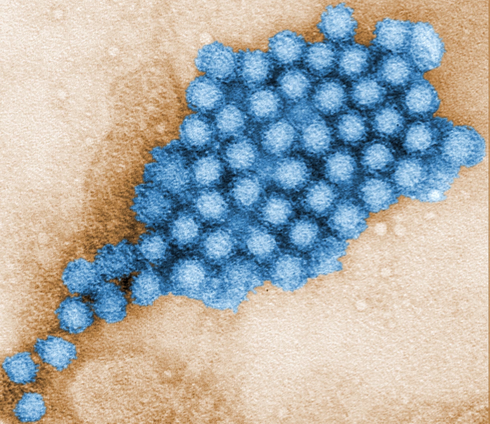 Norovirus Norovirus