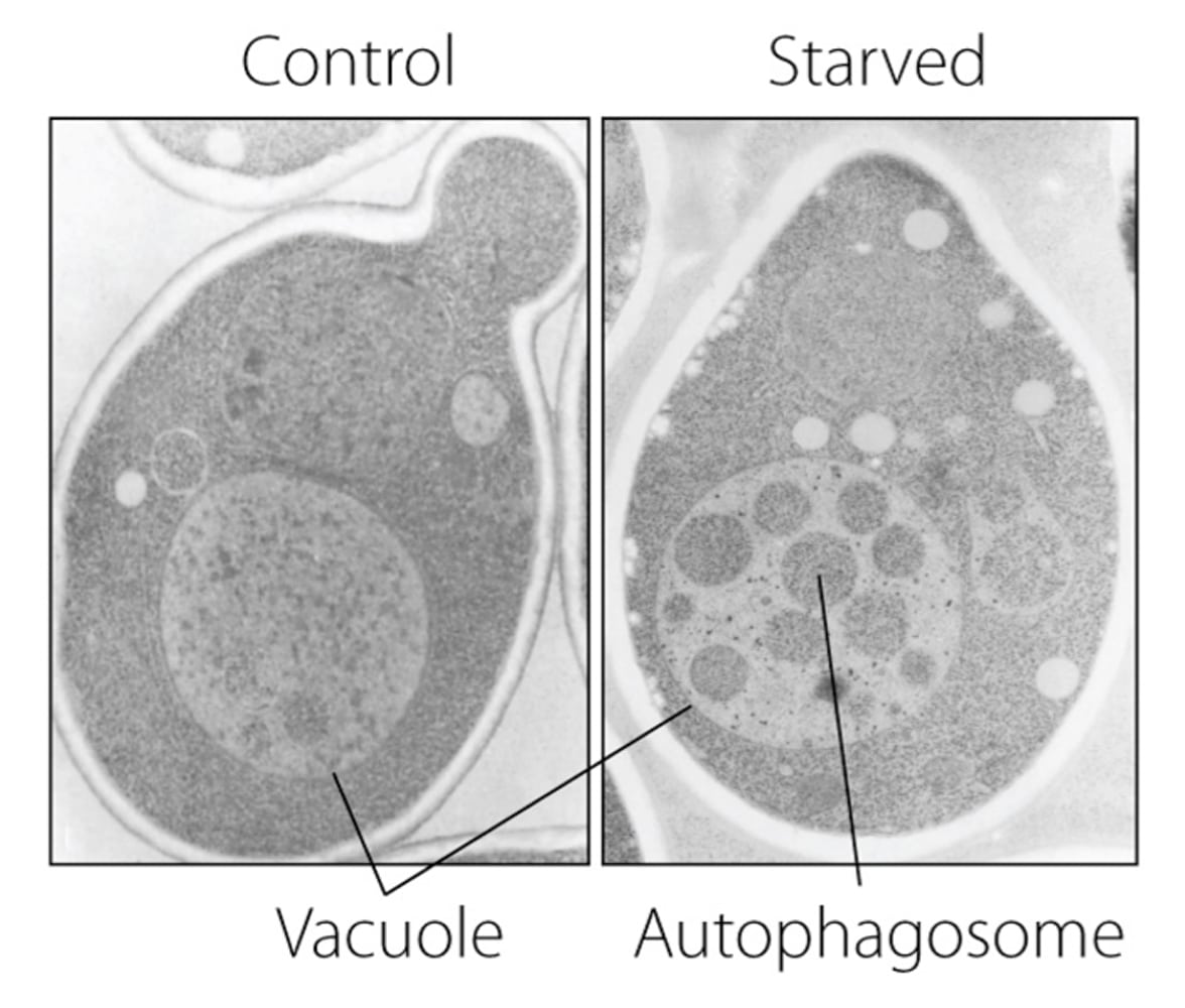 Mit und ohne Müllhalde: Vakuole von Hefezellen Mit und ohne Müllhalde: Vakuole von Hefezellen