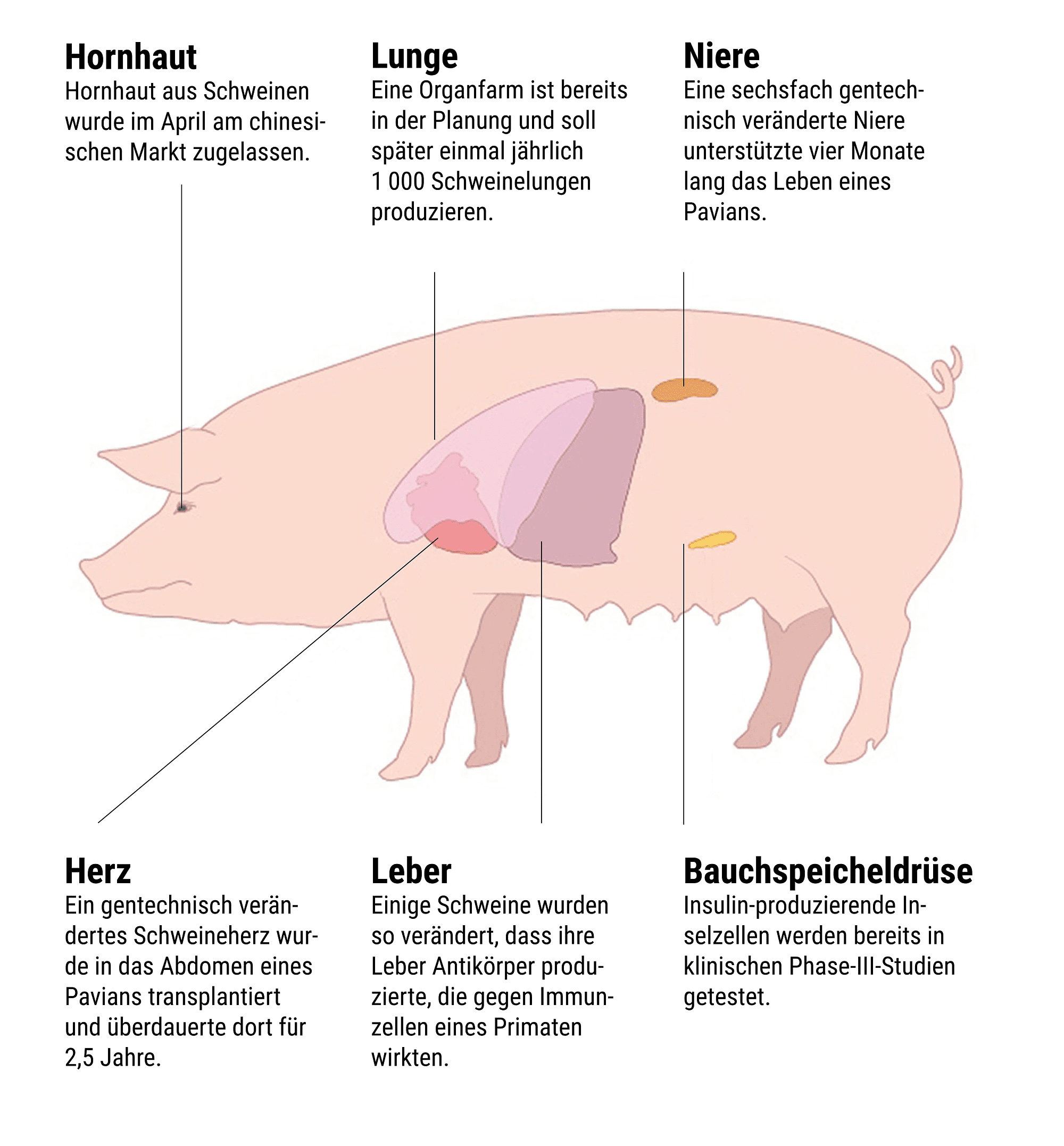 Transplantation von Schweineorganen Transplantation von Schweineorganen