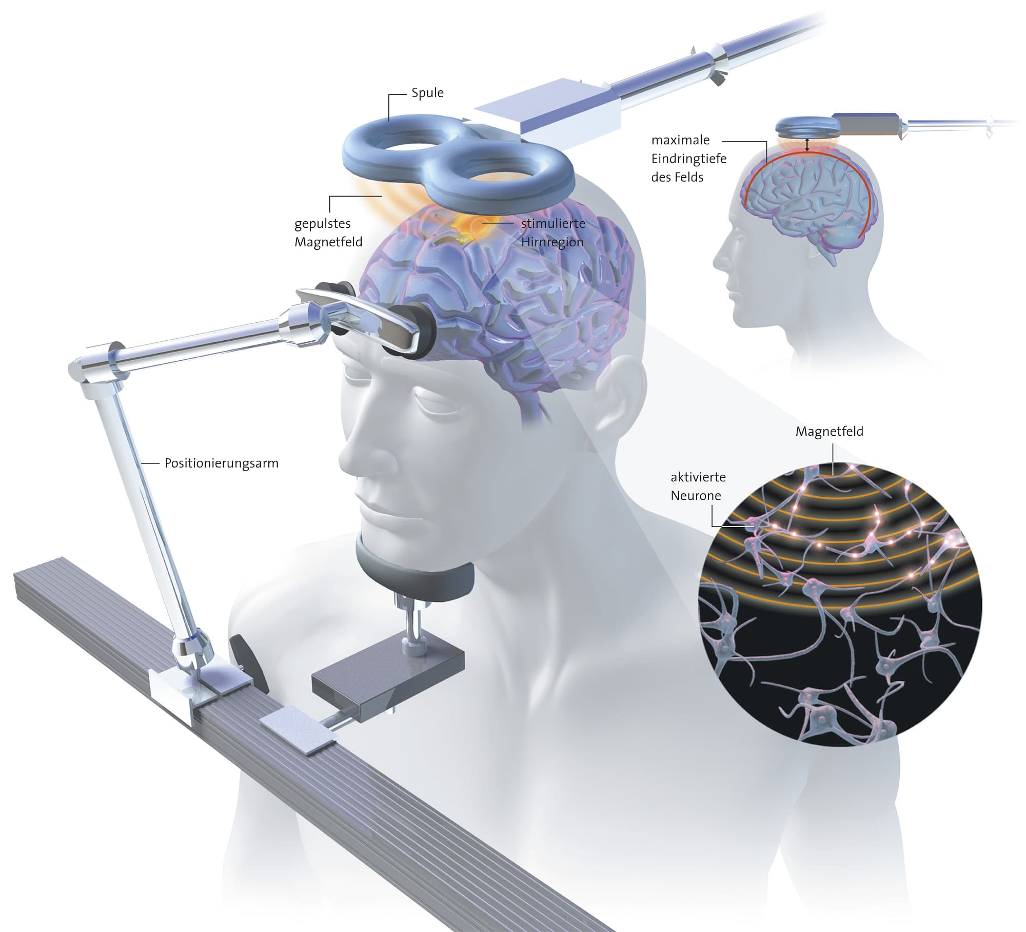 Hirnstimulation per Magnet Hirnstimulation per Magnet