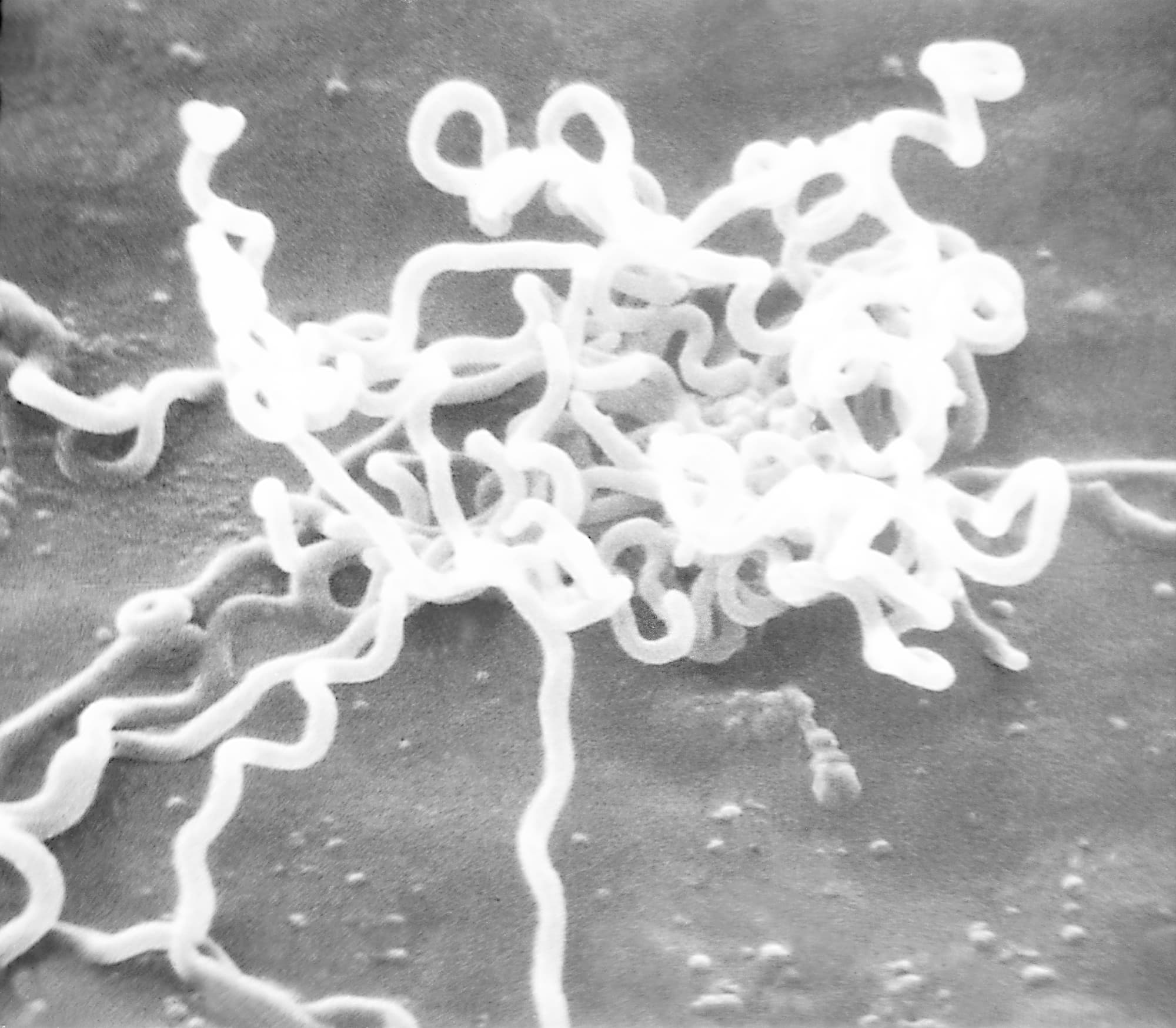 Elektrononmikroskopische Aufnahme des Syphilis-Erregers Treponema pallidum Elektrononmikroskopische Aufnahme des Syphilis-Erregers Treponema pallidum