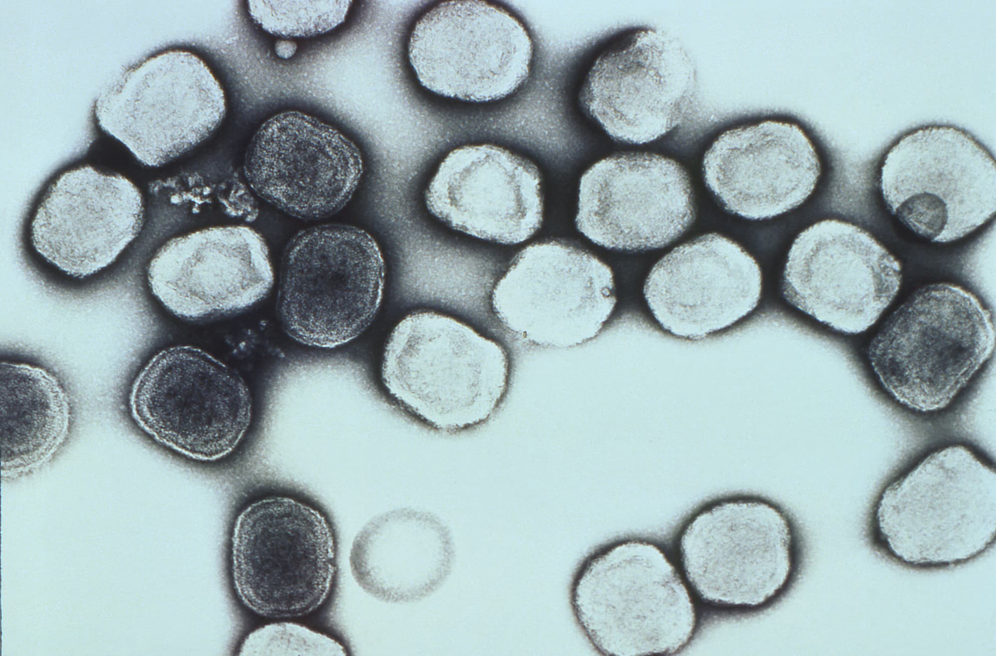 Pockenvirus Vaccinia Pockenvirus Vaccinia