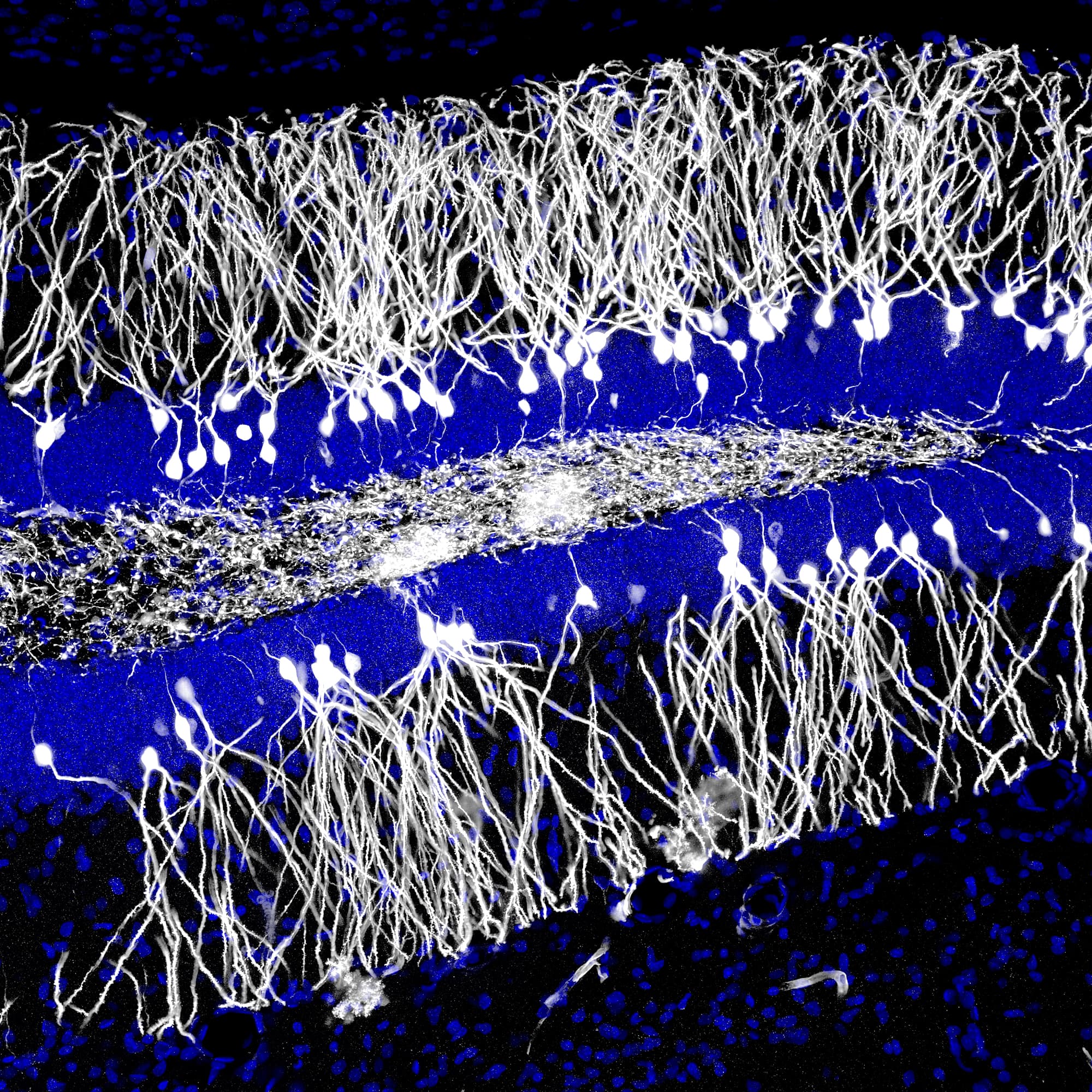 Neurone im Hippocampus Neurone im Hippocampus
