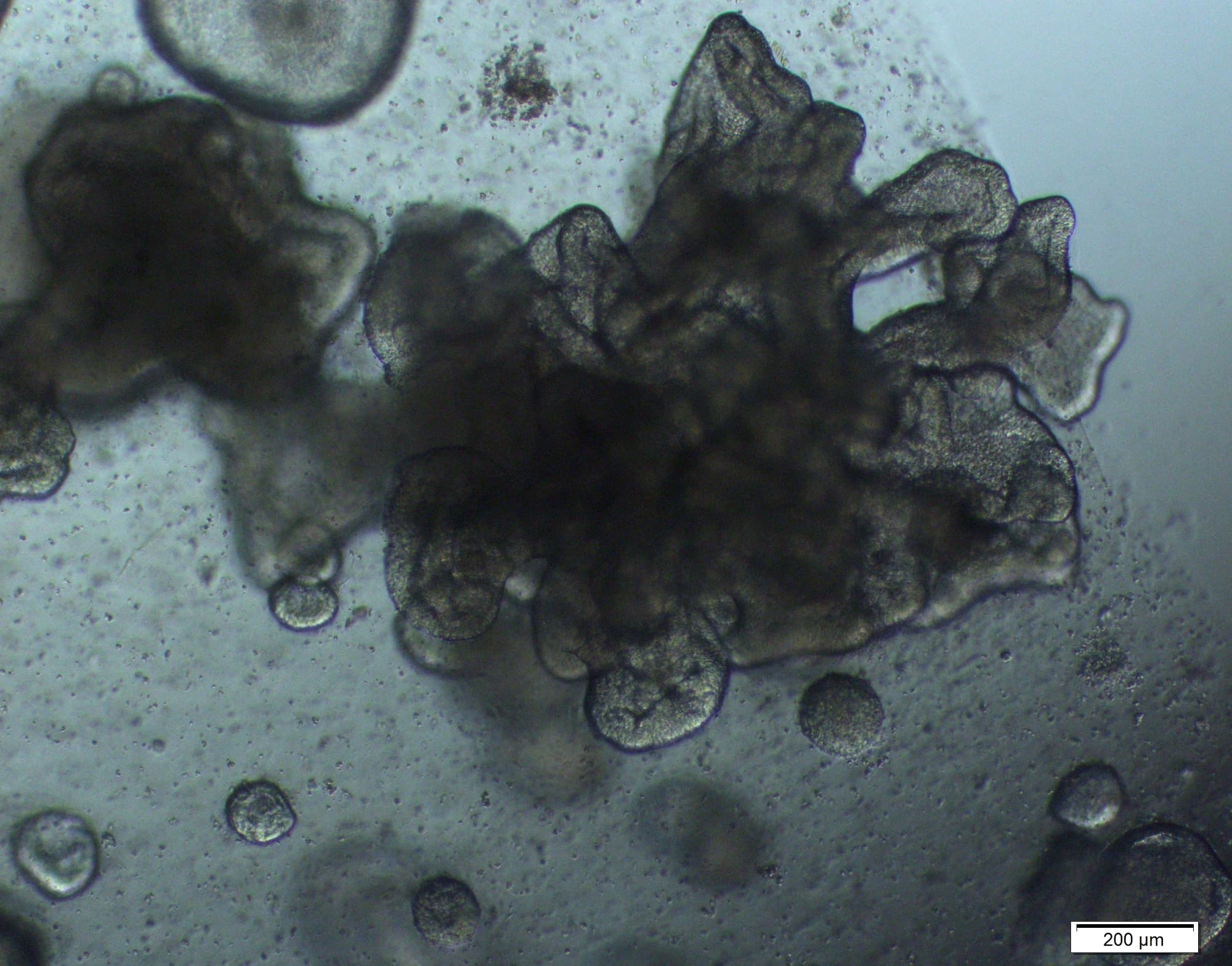 Das Organoid wurde aus Zellen aus den Luftsäckchen der Lunge, den Alveolen, gezüchtet. Das Organoid wurde aus Zellen aus den Luftsäckchen der Lunge, den Alveolen, gezüchtet.