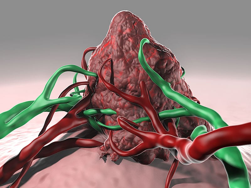 Individueller T-Zellbooster gegen Hautkrebs Individueller T-Zellbooster gegen Hautkrebs