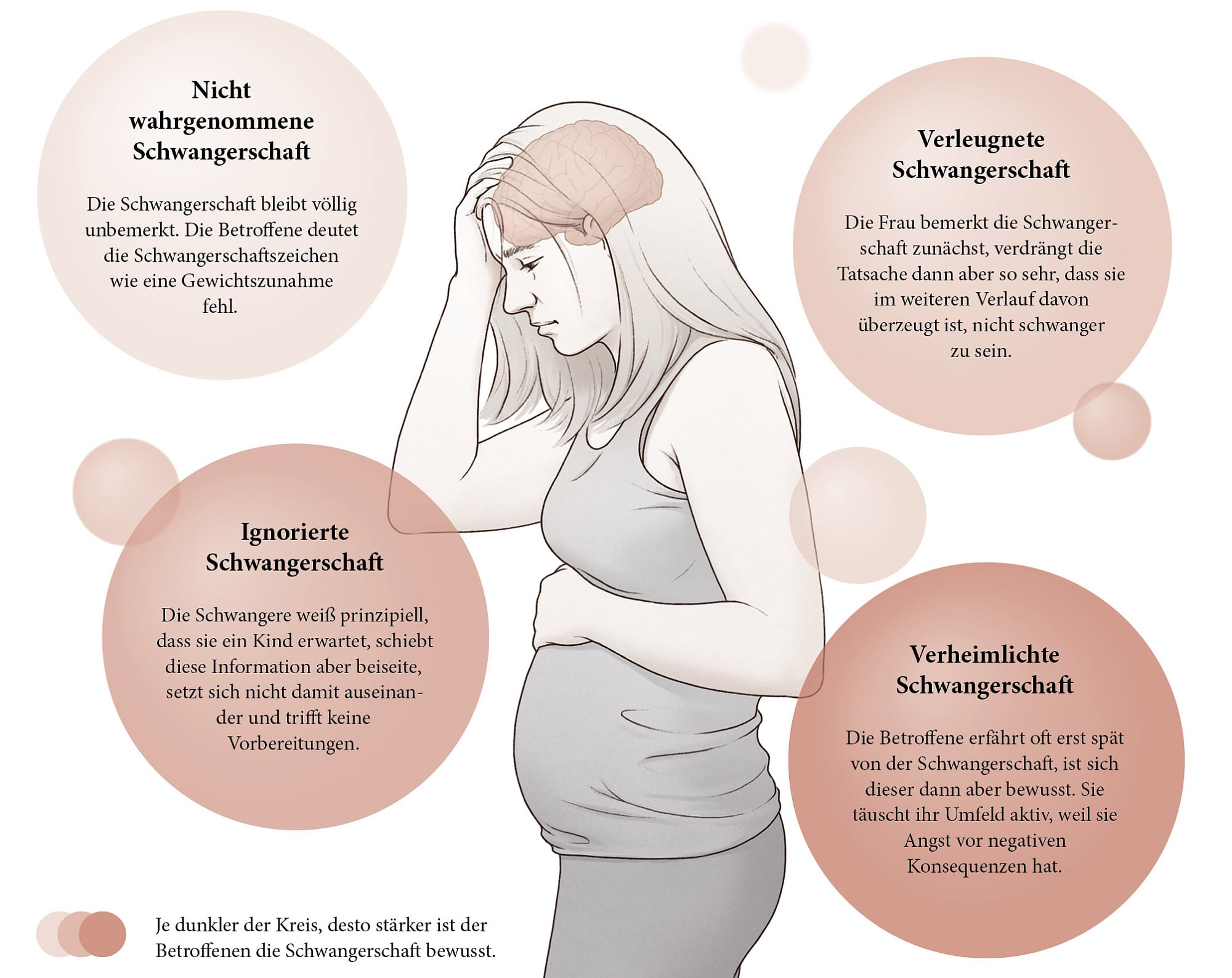 Vier Typen von Schwangerschaftsnegierung Vier Typen von Schwangerschaftsnegierung