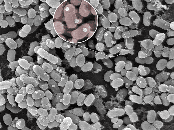 Prochlorococcus mit Vesikeln Prochlorococcus mit Vesikeln