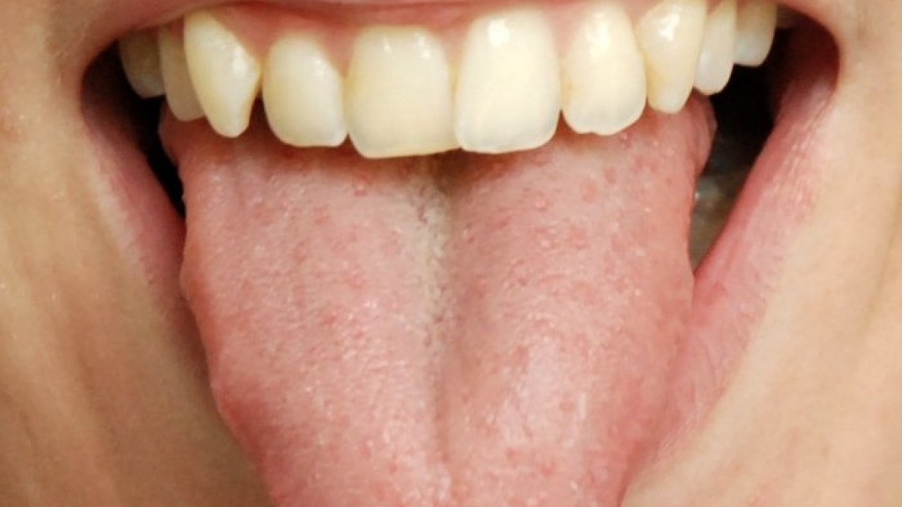 Anatomie Und Physiologie Mensch Erstaunliches Uber Den Korper Spektrum Der Wissenschaft