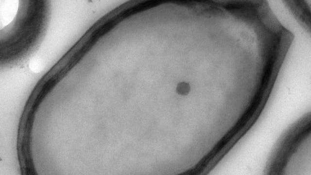 Neuer Größenrekord: Das Pandoravirus