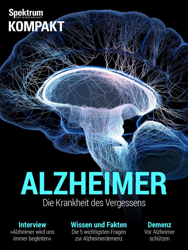 Spektrum Kompakt - 11/2014 - Alzheimer - Die Krankheit des Vergessens