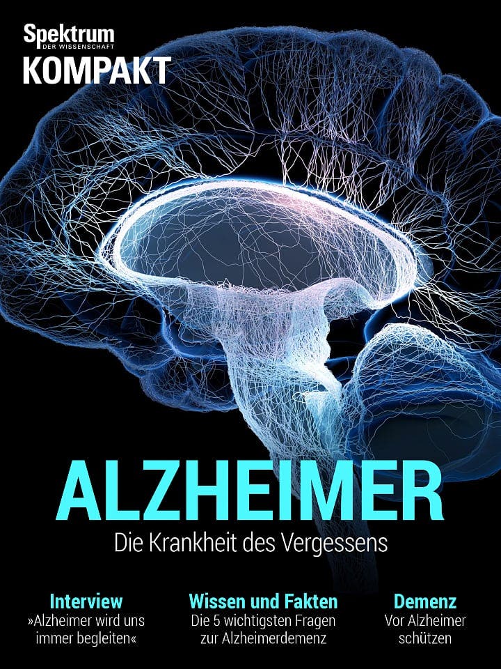 Spektrum Kompakt:  Alzheimer – Die Krankheit des Vergessens