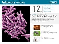 Spektrum - Die Woche - 12/2016 - Kehrt die Tuberkulose zurück?