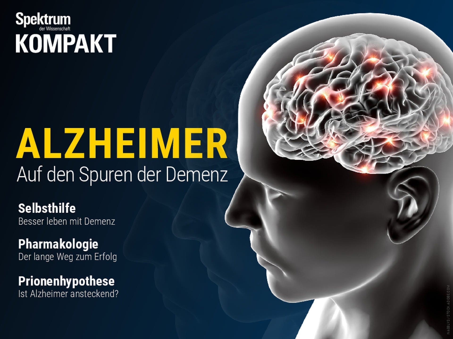Alzheimer - Auf den Spuren der Demenz