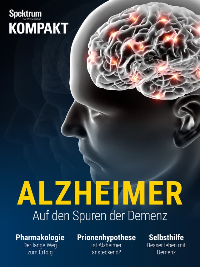 Spektrum Kompakt - 22/2017 - Alzheimer - Auf den Spuren der Demenz