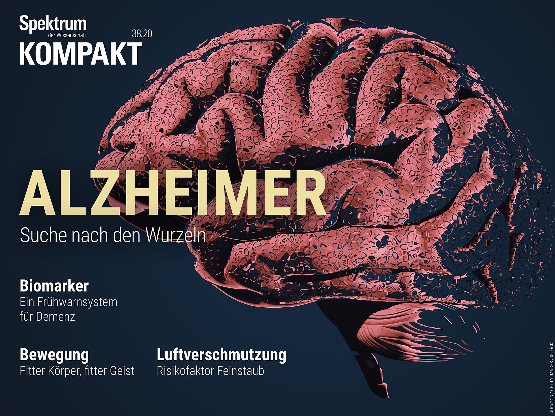 Alzheimer - Suche nach den Wurzeln