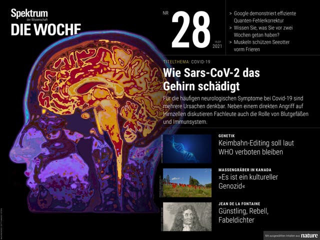 Spektrum - Die Woche - 28/2021 - Wie Sars-Cov-2 das Gehirn schädigt