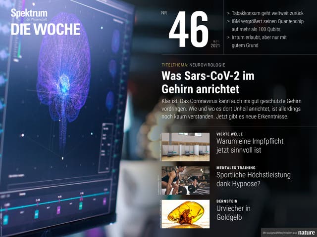 Spektrum - Die Woche - 46/2021 - Was SARS-CoV-2 im Gehirn anrichtet