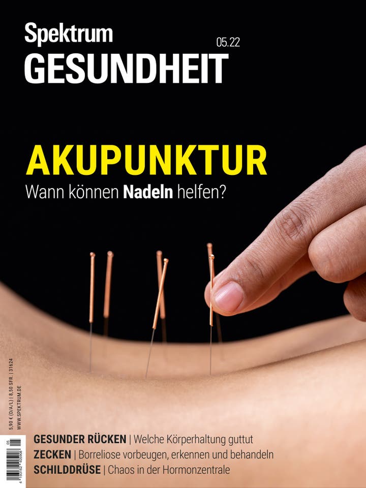 Spektrum Gesundheit - 5/2022 - Akupunktur – Wann können Nadeln helfen?