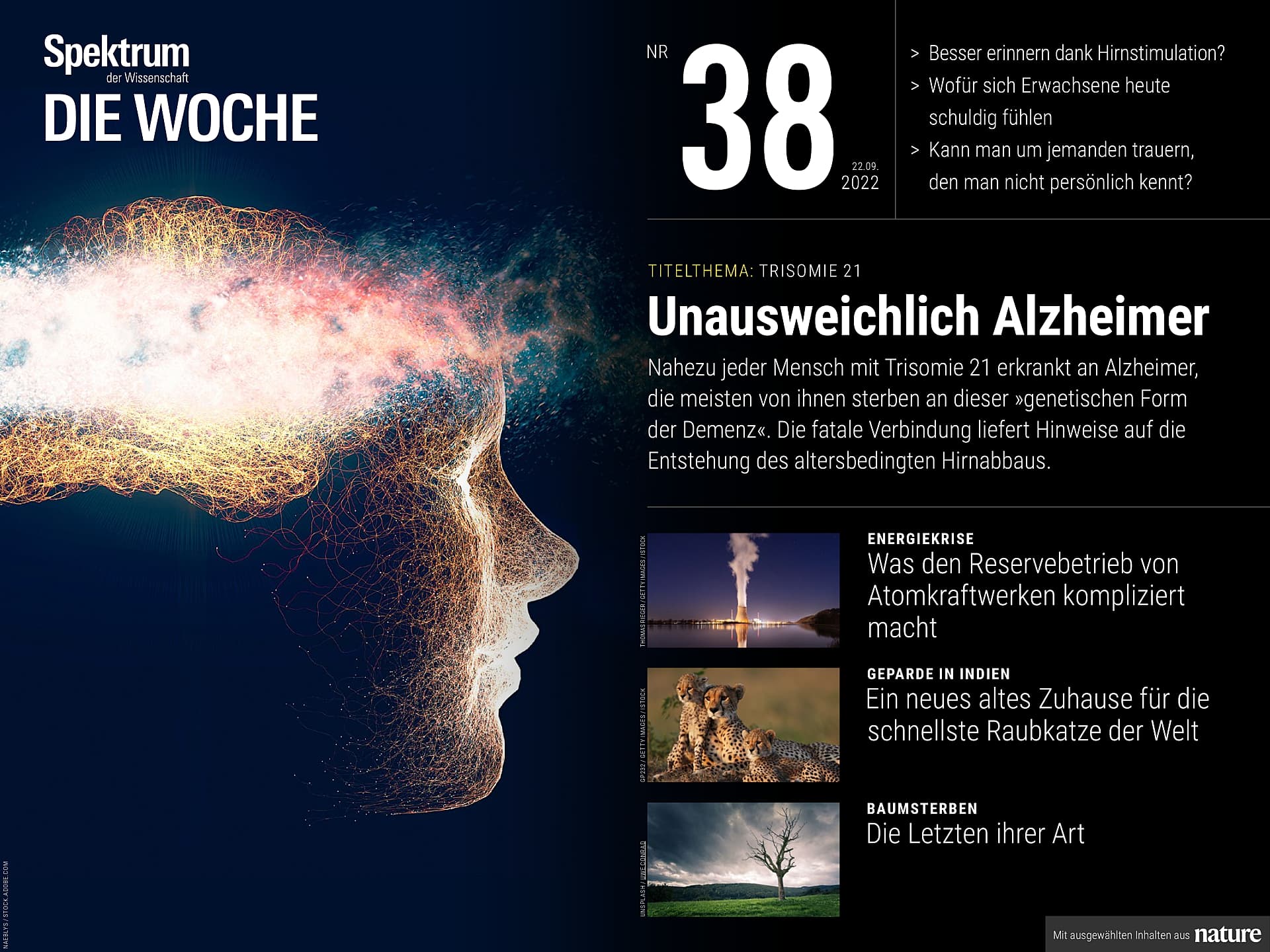 Trisomie 21 – Automatisch Alzheimer